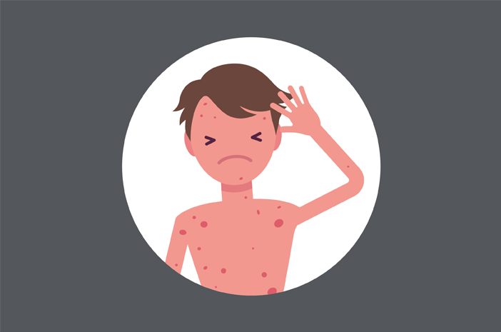 Obat Sipilis Generik